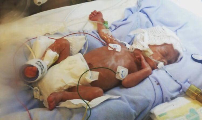 Other image for Fighter Louie hoping to get vital surgery